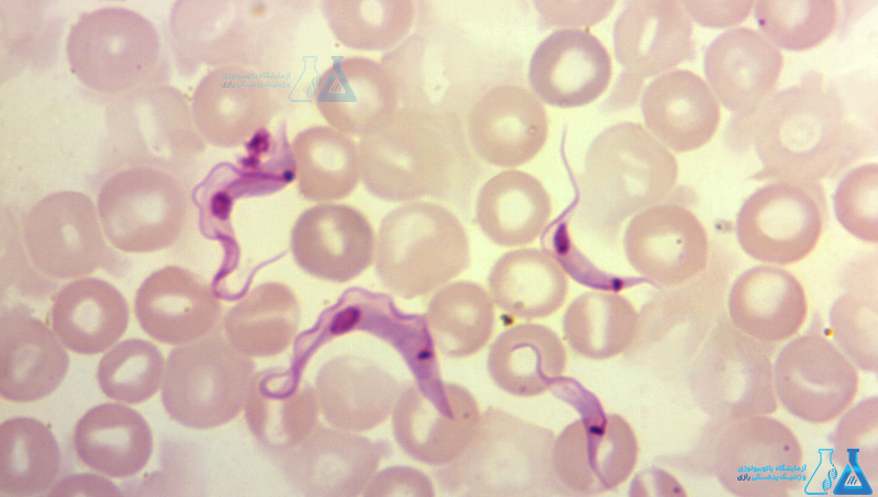 آزمایش Blood Smear